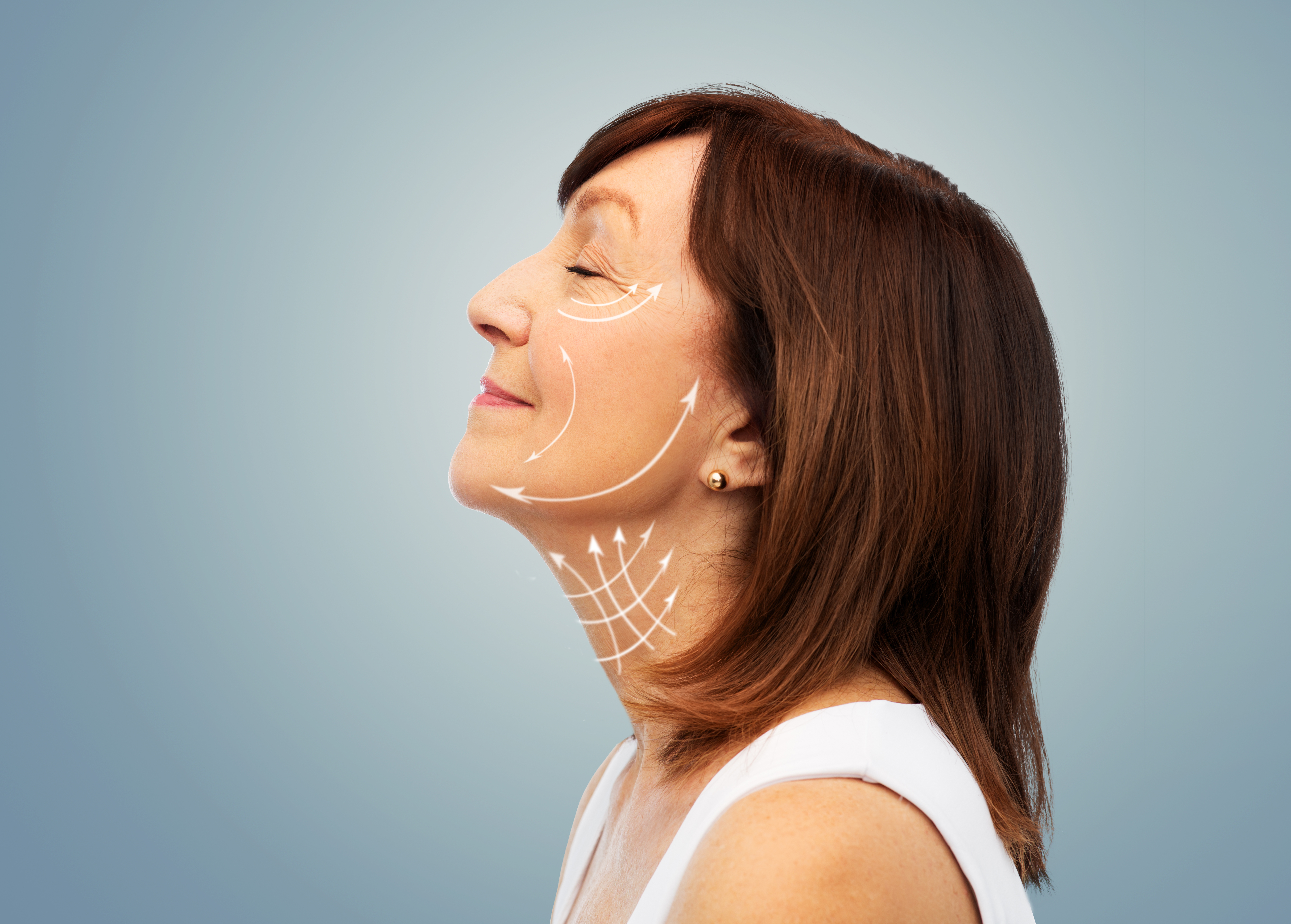 Deep plane face- en halslift Deep plane face- en halslift